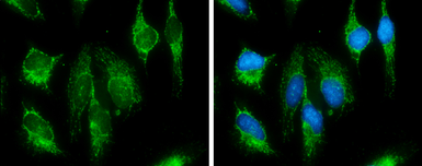 Anti-SDHB antibody used in Immunocytochemistry/ Immunofluorescence (ICC/IF). GTX113833