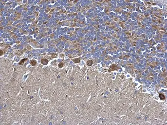 Anti-SDHB antibody used in IHC (Paraffin sections) (IHC-P). GTX113833