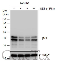 Anti-SET antibody used in Western Blot (WB). GTX113834