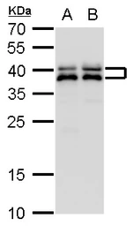 Anti-SET antibody used in Western Blot (WB). GTX113834