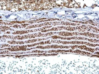 Anti-Tropomyosin 1 antibody used in IHC (Paraffin sections) (IHC-P). GTX113857