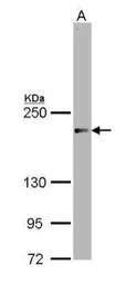 Anti-SRC3 antibody [N1N2], N-term used in Western Blot (WB). GTX113869