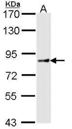 Anti-Cullin 4a antibody [N1C1] used in Western Blot (WB). GTX113876