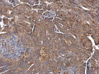 Anti-Cullin 7 antibody [C2C3], C-term used in IHC (Paraffin sections) (IHC-P). GTX113906
