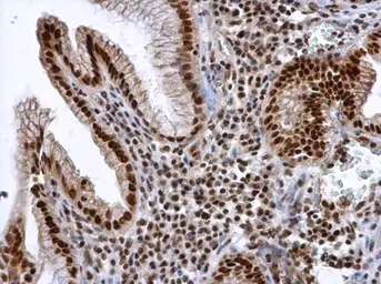Anti-ALY antibody used in IHC (Paraffin sections) (IHC-P). GTX113917
