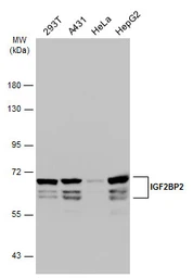 Anti-IGF2BP2 antibody used in Western Blot (WB). GTX113922