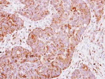 Anti-IGF2BP2 antibody used in IHC (Paraffin sections) (IHC-P). GTX113922