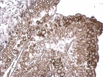 Anti-RUVBL2 antibody [N1C1] used in IHC (Paraffin sections) (IHC-P). GTX113926