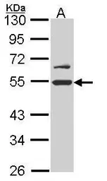 Anti-RUVBL2 antibody [N1C1] used in Western Blot (WB). GTX113926