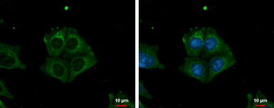 Anti-TRIM32 antibody used in Immunocytochemistry/ Immunofluorescence (ICC/IF). GTX113937