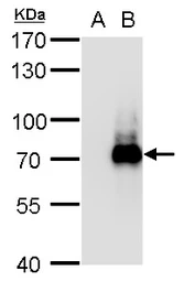 Anti-TRIM32 antibody used in Western Blot (WB). GTX113937