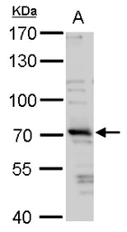Anti-TRIM32 antibody used in Western Blot (WB). GTX113937