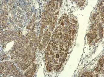 Anti-PAD4 antibody used in IHC (Paraffin sections) (IHC-P). GTX113945