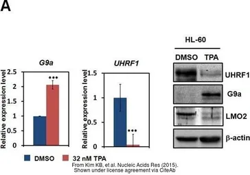 Anti-UHRF1 antibody used in Western Blot (WB). GTX113963