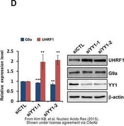 Anti-UHRF1 antibody used in Western Blot (WB). GTX113963