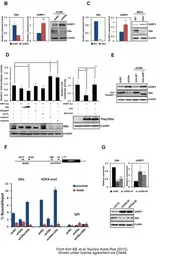 Anti-UHRF1 antibody used in Western Blot (WB). GTX113963