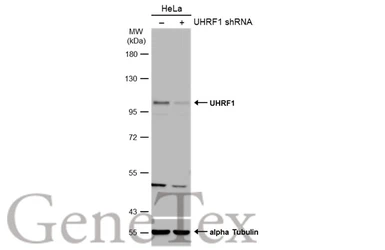 Anti-UHRF1 antibody used in Western Blot (WB). GTX113963