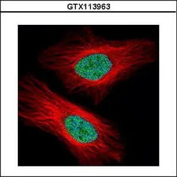 Anti-UHRF1 antibody used in Immunocytochemistry/ Immunofluorescence (ICC/IF). GTX113963