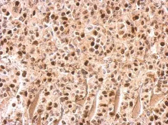 Anti-UHRF1 antibody used in IHC (Paraffin sections) (IHC-P). GTX113963