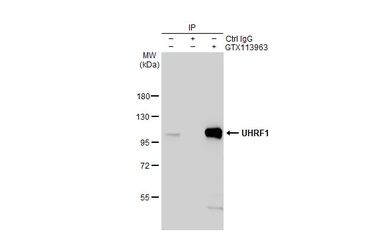 Anti-UHRF1 antibody used in Immunoprecipitation (IP). GTX113963