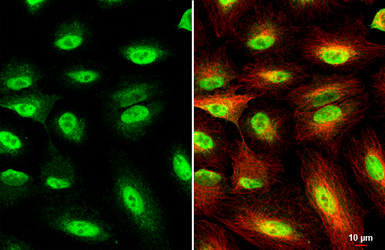 Anti-UHRF1 antibody used in Immunocytochemistry/ Immunofluorescence (ICC/IF). GTX113963