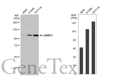 Anti-UHRF1 antibody used in Western Blot (WB). GTX113963