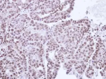 Anti-TRIB3 antibody [N3C3] used in IHC (Paraffin sections) (IHC-P). GTX113991