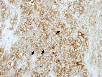 Anti-COMT antibody used in IHC (Paraffin sections) (IHC-P). GTX114062