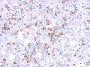 Anti-CYP27A1 antibody used in IHC (Paraffin sections) (IHC-P). GTX114065