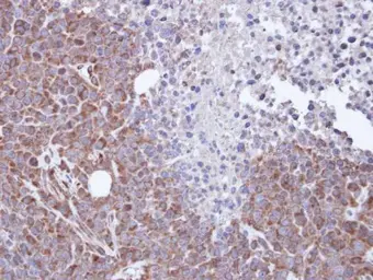 Anti-FHL2 antibody used in IHC (Paraffin sections) (IHC-P). GTX114072