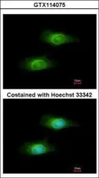 Anti-GCLM antibody used in Immunocytochemistry/ Immunofluorescence (ICC/IF). GTX114075