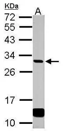 Anti-GCLM antibody used in Western Blot (WB). GTX114075