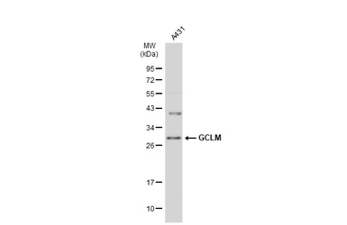 Anti-GCLM antibody used in Western Blot (WB). GTX114075