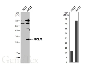 Anti-GCLM antibody used in Western Blot (WB). GTX114075