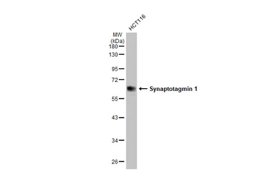 Anti-Synaptotagmin 1 antibody [N1C2] used in Western Blot (WB). GTX114124