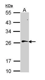 Anti-RAN antibody used in Western Blot (WB). GTX114139