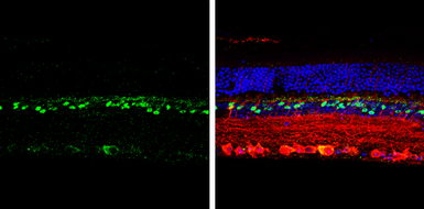 Anti-CHX10 antibody used in IHC (Paraffin sections) (IHC-P). GTX114143