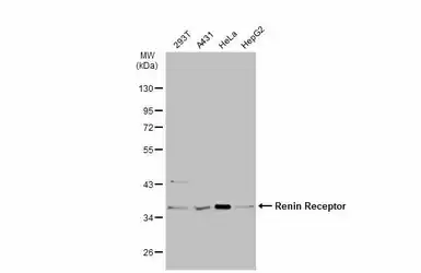 Anti-Renin Receptor antibody [N3C3] used in Western Blot (WB). GTX114169