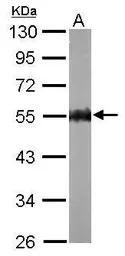 Anti-AMPK gamma 2 antibody [C2C3], C-term used in Western Blot (WB). GTX114178