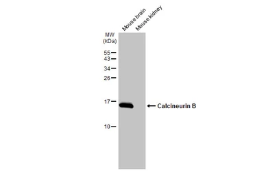 Anti-Calcineurin B antibody used in Western Blot (WB). GTX114181