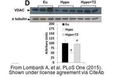 Anti-VDAC1 antibody [N1C2] used in Western Blot (WB). GTX114187