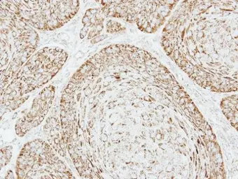 Anti-VDAC1 antibody [N1C2] used in IHC (Paraffin sections) (IHC-P). GTX114187