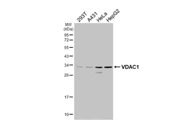 Anti-VDAC1 antibody [N1C2] used in Western Blot (WB). GTX114187