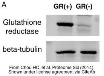 Anti-Glutathione Reductase antibody [N2C2], Internal used in Western Blot (WB). GTX114199