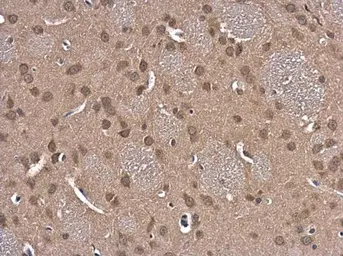 Anti-Glutathione Reductase antibody [N2C2], Internal used in IHC (Paraffin sections) (IHC-P). GTX114199