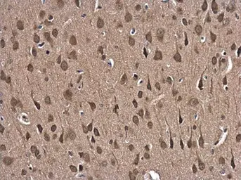 Anti-Glutathione Reductase antibody [N2C2], Internal used in IHC (Paraffin sections) (IHC-P). GTX114199