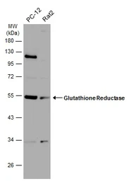 Anti-Glutathione Reductase antibody [N2C2], Internal used in Western Blot (WB). GTX114199