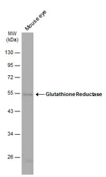 Anti-Glutathione Reductase antibody [N2C2], Internal used in Western Blot (WB). GTX114199