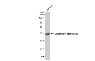 Anti-Glutathione Reductase antibody [N2C2], Internal used in Western Blot (WB). GTX114199