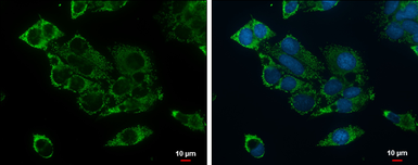 Anti-ACADSB antibody used in Immunocytochemistry/ Immunofluorescence (ICC/IF). GTX114231